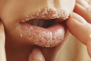 How to get rid of dry lips