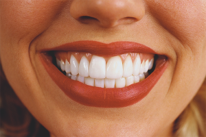 Comment rendre les dents blanches